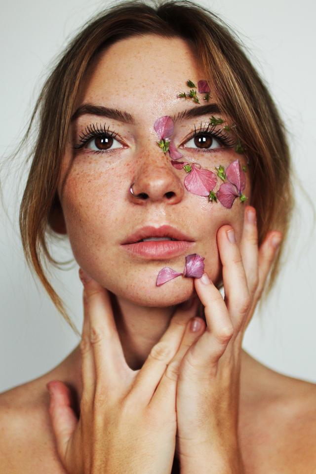 Fakta Tentang <i>Freckles</i>, Bintik-Bintik Cokelat di Wajah yang Jadi Tren Kecantikan